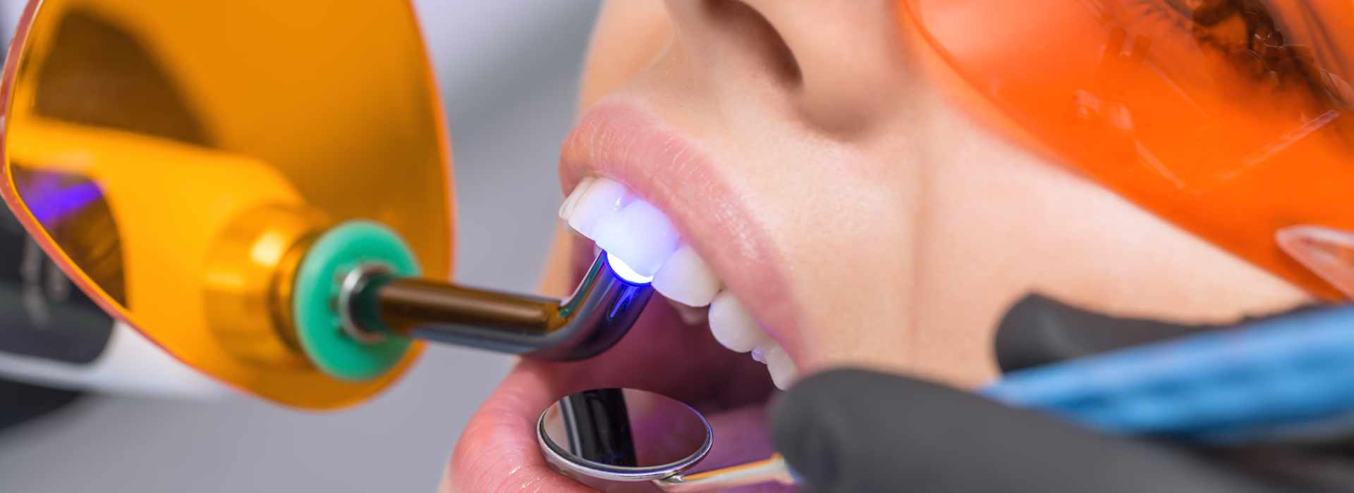 A woman is having restorative dental treatment.